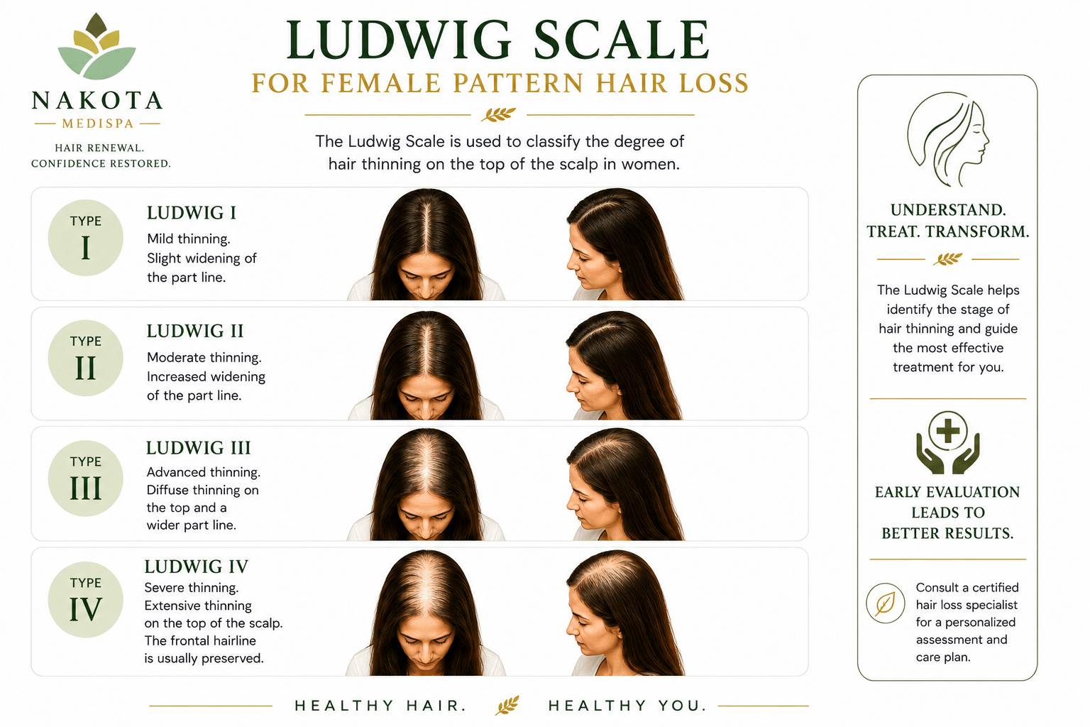 Ludwig scale for Female Pattern Baldness_Nakota MediSpa Ottawa